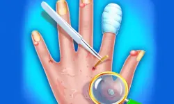 Hand Skin Doctor - Hospital Game